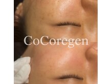 サゥオルサロン(sawalsalon)の雰囲気（韓国で人気の最新シミケア、隠す肌から魅せる肌へ、驚きの輝きを）