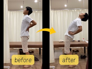 可児ボディーメイク接骨院/腰痛(男性)