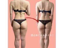 ヨサパーク カリーナ(YOSA PARK carina)