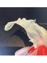 ヴィアージュ(Viage)/艶肌waxで産毛除去