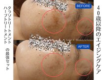 サロン ケイ(Salon K)の雰囲気（ファンデーションで隠す肌から卒業！若い頃の肌へ肌質改善♪）