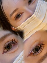 サンティエ(scintiller)/Dカール