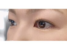 シュール(Sure)/ストレート