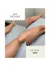【男性】新生活応援☆VIO+両脚+へそ下ワックス脱毛下半身Set¥21,500→¥15,500