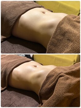 ビアンジュ(biange)の写真/本気でボディーラインを整えたいあなたへ。冷え・ポッコリお腹改善へ◎