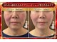 ラシクビューティールームの写真/30代からの食いしばり・たるみケア・フェイスライン・ほうれい線に

