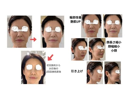 スキャニング@ラボエステの写真