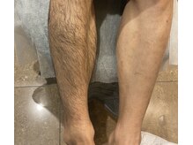 アンドメイル(&male)の雰囲気(奥様や彼女に「体毛が濃すぎる」と言われる日々からの卒業へ!)