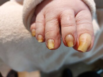 爪切り屋 足楽/硬い爪