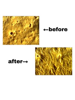 ベルシック(Belchic)/肌のキメで全てが決まる