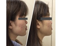 サロン ド ルル(salon de Lulu)/人気No. 1★セルキュア