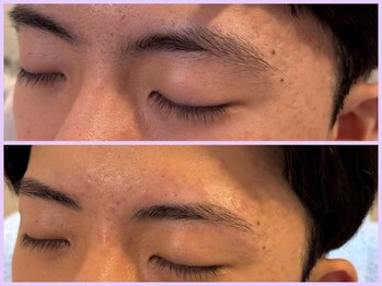 スリーピース(3Peace)/アーチ眉 Before/After