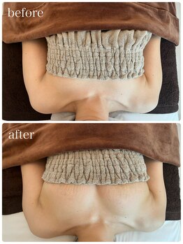 リノ 行橋(lino)/◇バストアップ症例◇30代