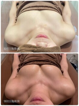 ロココ 金沢店(Rococo)/戻らないバスト目指します!