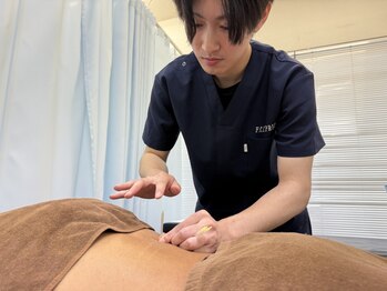 F.C.C.よみうりランド整骨院の写真/コリを根本から改善する本格鍼灸が受けられる☆むくみ/肌荒れ改善の美容鍼も◎