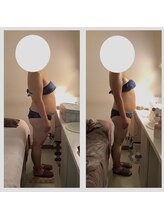 アクア エステティコ 亀有(ACQUA estetico)/痩身　90分上半身