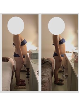 アクア エステティコ 亀有(ACQUA estetico)/痩身　90分上半身