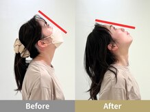 せなかのはね 井尻店/30代　女性　猫背　睡眠の質