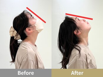 せなかのはね 井尻店/30代　女性　猫背　睡眠の質