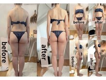 リープ(lieb)の雰囲気(ブライダルのお客様9ヶ月の変化/施術全身6回+部分ケア6回)