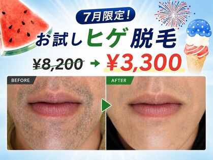 ビビの写真