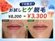 ビビの写真