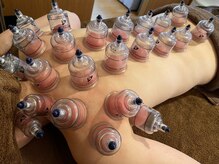 フェルヴィータ(Felvita)/