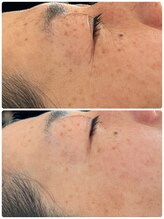 サロン ウイ(salon u'i)/～リブセラ～