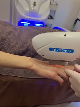 カーム(CALM)/【手の甲指の脱毛中のお客様♪】