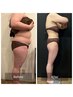 【まずは相談◎】ダイエットに関して無料カウンセリング
