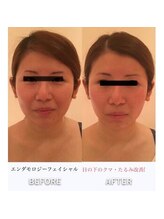 ビューティースパ/たった5分で小顔になれる♪