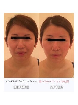 ビューティースパ/たった5分で小顔になれる♪