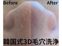 マヴィ(Mavie)の雰囲気（石巻初導入◎韓国式３D毛穴洗浄！毛穴の黒ずみ汚れがスッキリ！）
