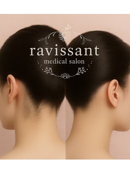 ラヴィソン(ravissant)/