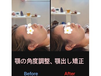 美容矯正サロン レレポノ(LELEPONO)/