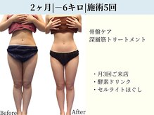 京都フォーエイチ(京都4H)/30代|2ヶ月|－6キロ|施術5回