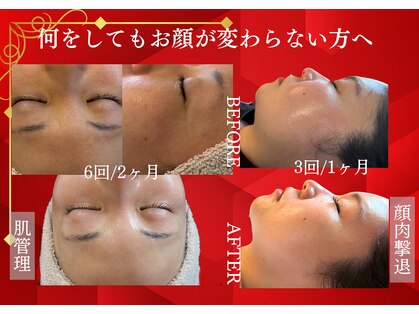 シェリー トウキョウ 西葛西店(Cherie Tokyo)の写真