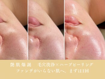 スカイ(sky)/毛穴洗浄×ハーブ1回効果