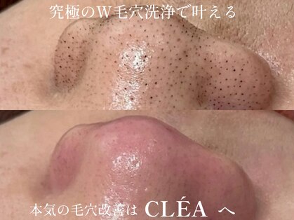 クレア(CLEA)の写真