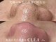クレア(CLEA)の写真
