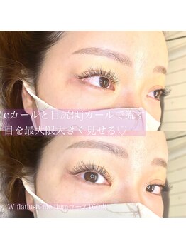 ベル(Belle)/Wフラット、ミディアムコース