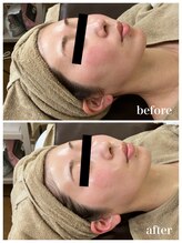 ジャスミン(Jasmin)/臍帯血幹細胞×NMN×AC-11