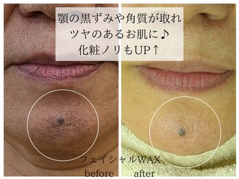 ラミーユ(La Miu)/WAXで毛穴汚れスッキリ♪