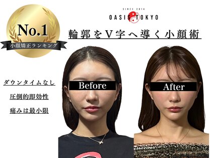 ネオオアシストウキョウ(ネオ OASIS TOKYO)の写真