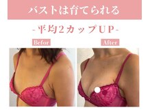 ラディス(Radice.)