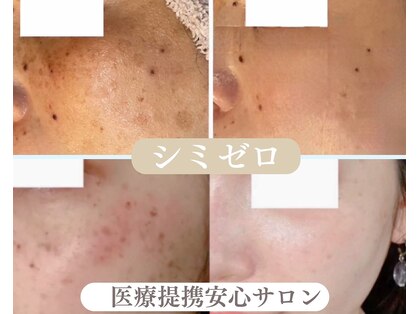 ローズルート(Rose route)の写真