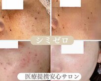 ローズルート(Rose route)