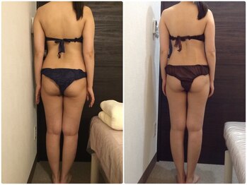 ウェリナ平和堂長久手院/小顔矯正/骨盤矯正/美脚サロン