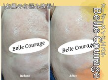 ベルクラージュ(Belle Courage)
