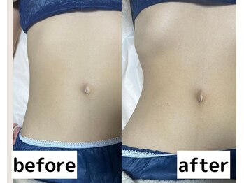 ライム 錦糸町(LIME)/Before/After